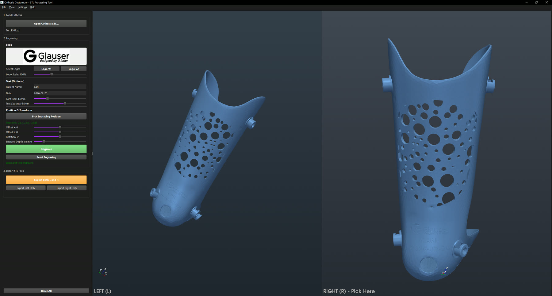 Orthosis Customizer desktop app: engraving controls on the left, left and right orthosis 3D views